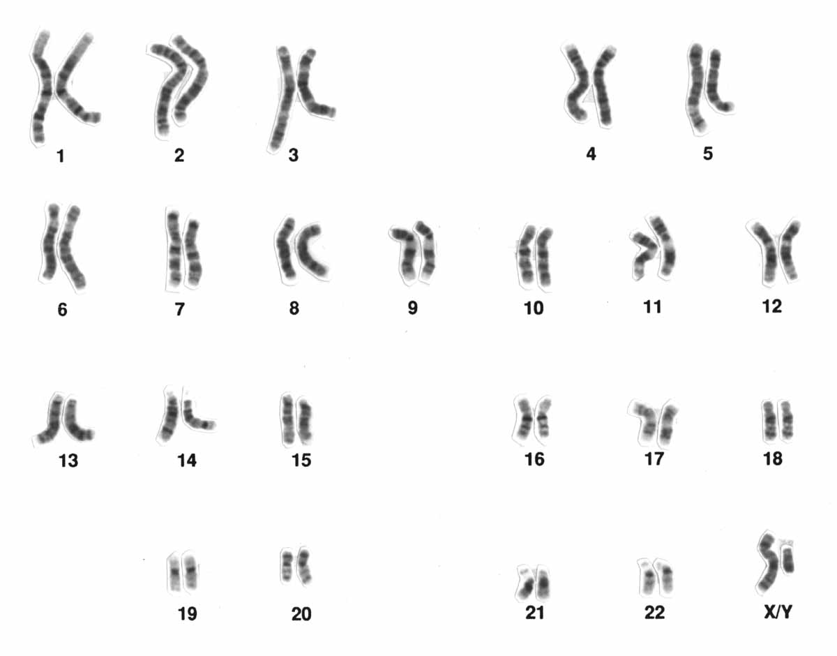 XY_ Karyotype